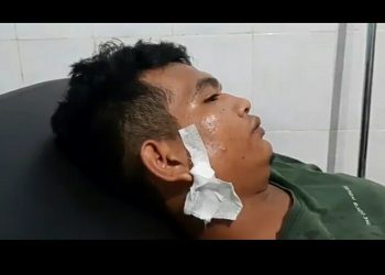 Dua Remaja Ditembak Orang Tak Dikenal Usai Santap Sahur