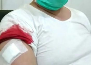 Syekh Ali Jaber Cabut Sendiri Patahan Pisau Di Lengan