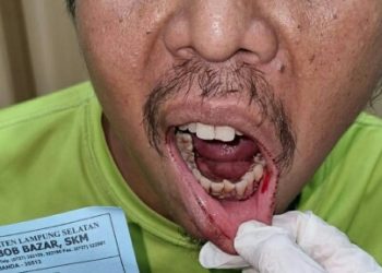 Ditabrak Dari Belakang,  Ridho Malah Dianiaya Keluarga Penabrak