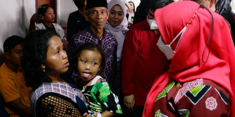 HUT Ke-341 Bandar Lampung, Pemkot Gelar Operasi Bibir Sumbing dan Celah Langit-lagit Gratis